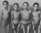 Pairs of Gypsy twins Auschwitz experiments